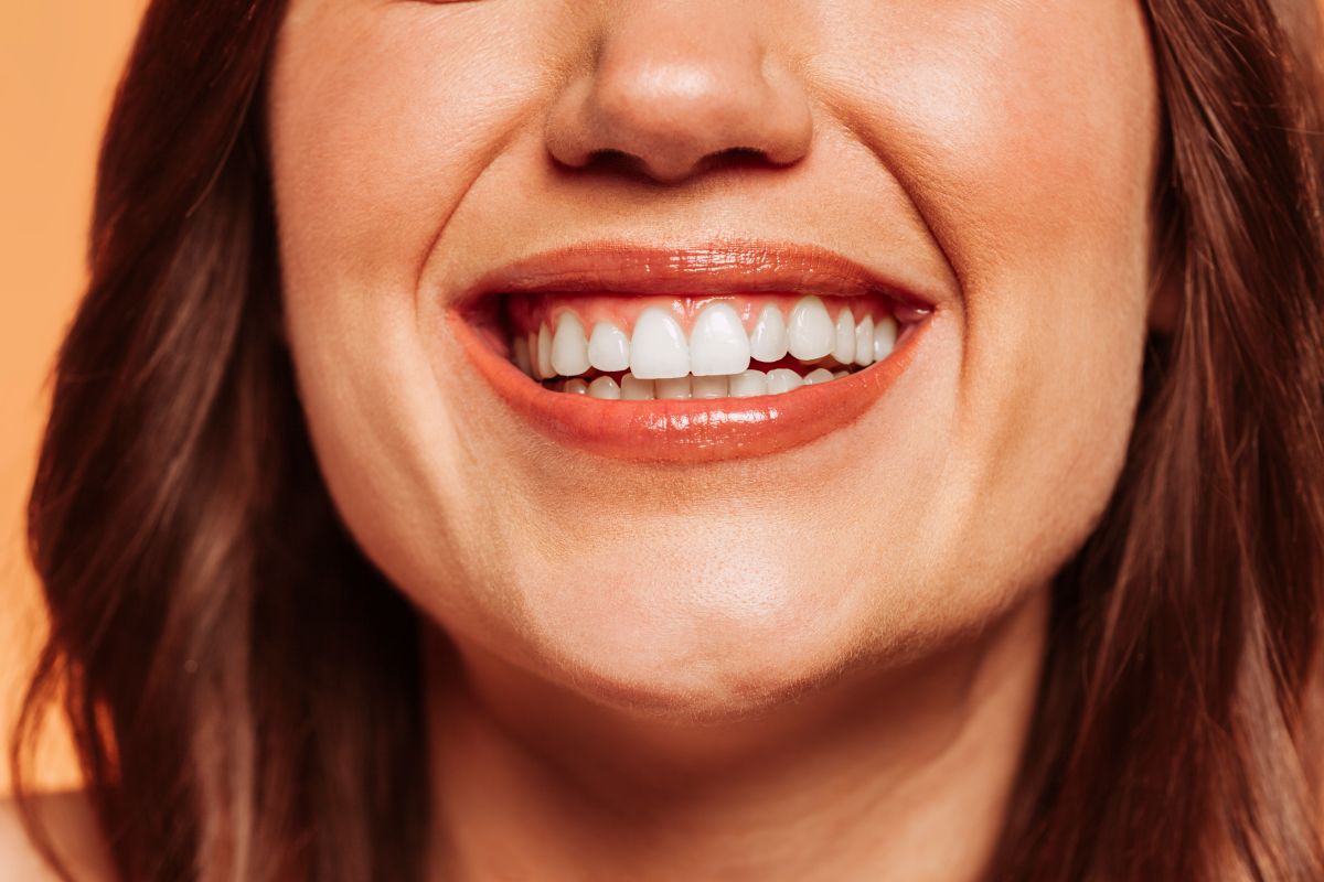 Patient smiling after dental bonding treatment at Bay Area Dental Fremont CA