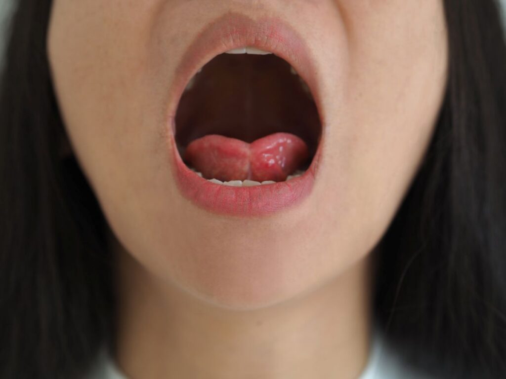 Open mouth facing the camera, showing a pink tongue and teeth inside the mouth
