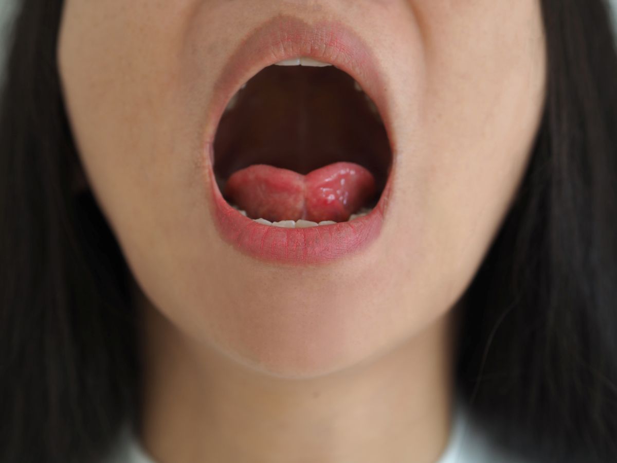 Open mouth facing the camera, showing a pink tongue and teeth inside the mouth