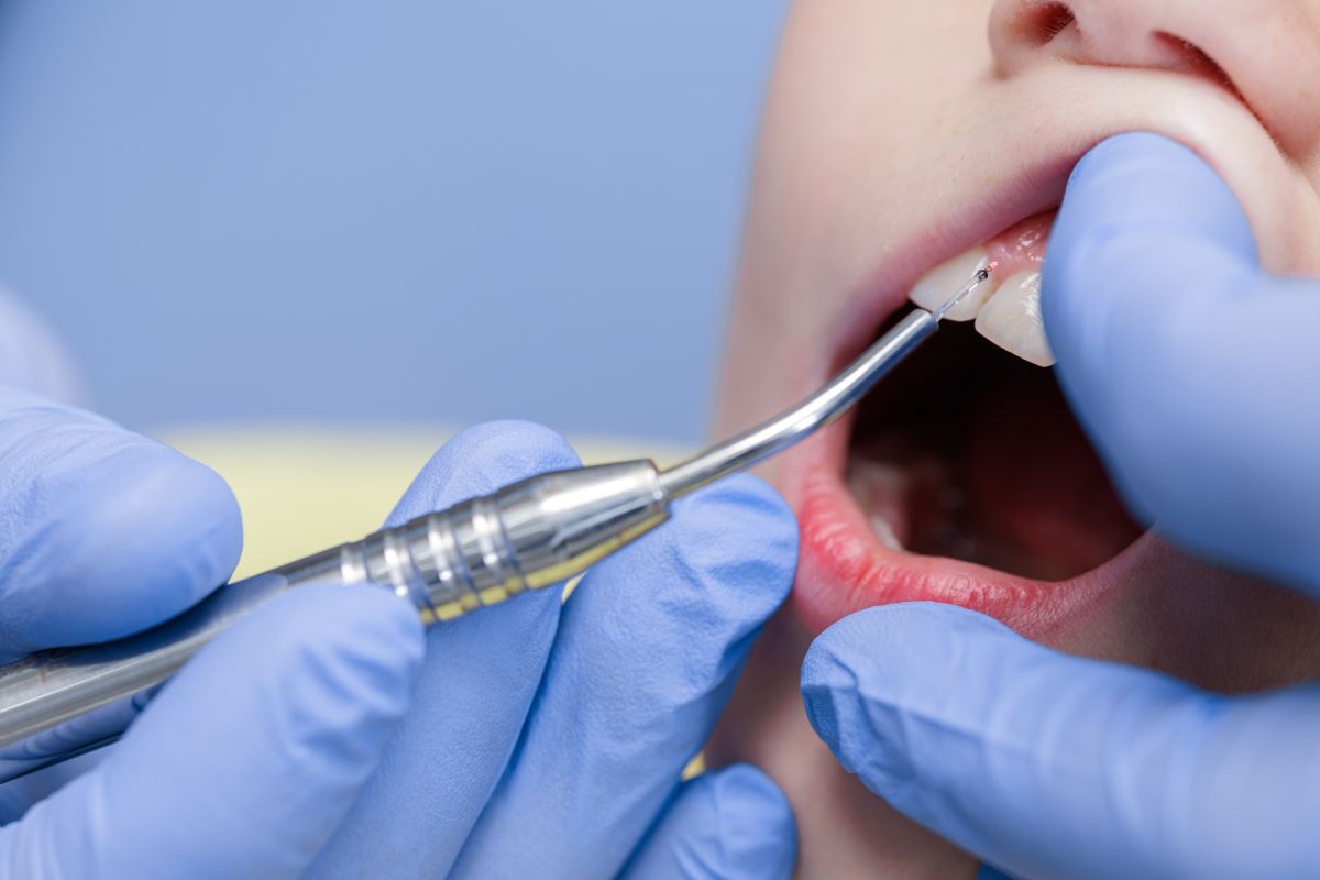 Close-up of a dentist in blue gloves using a dental instrument to examine a patient’s front teeth.