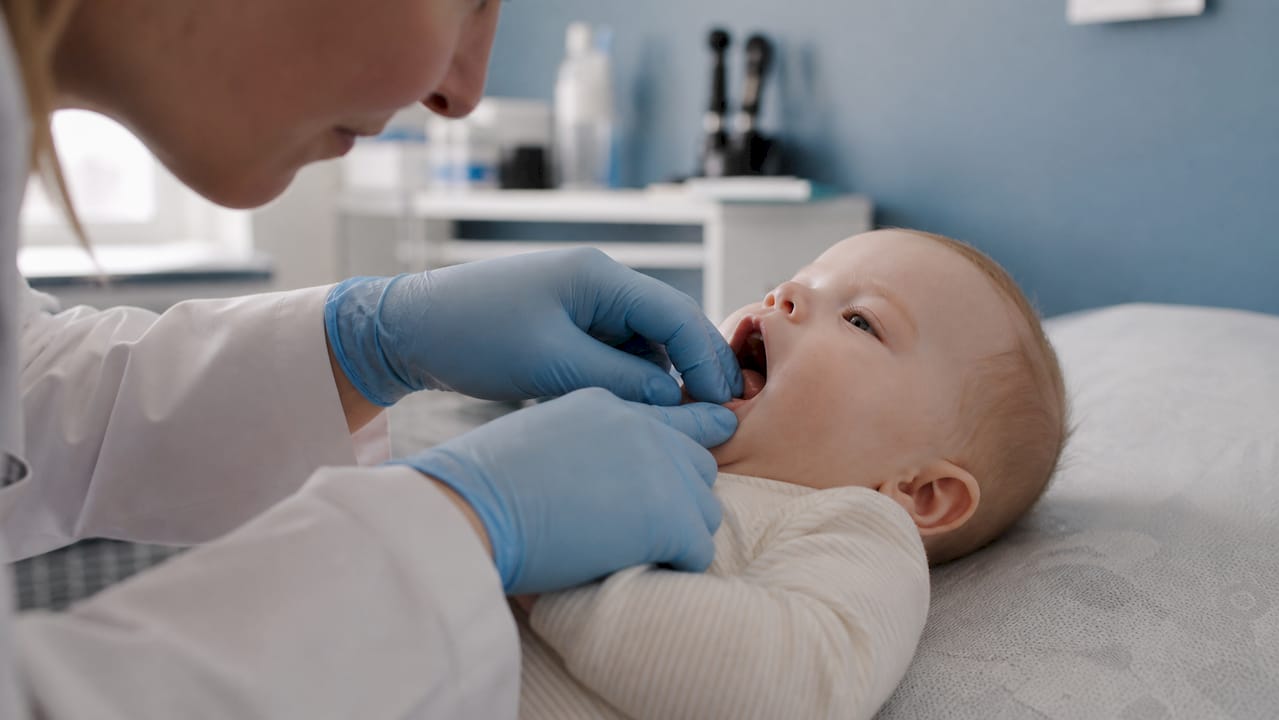Doctor lifting infant tongue for diagnosis