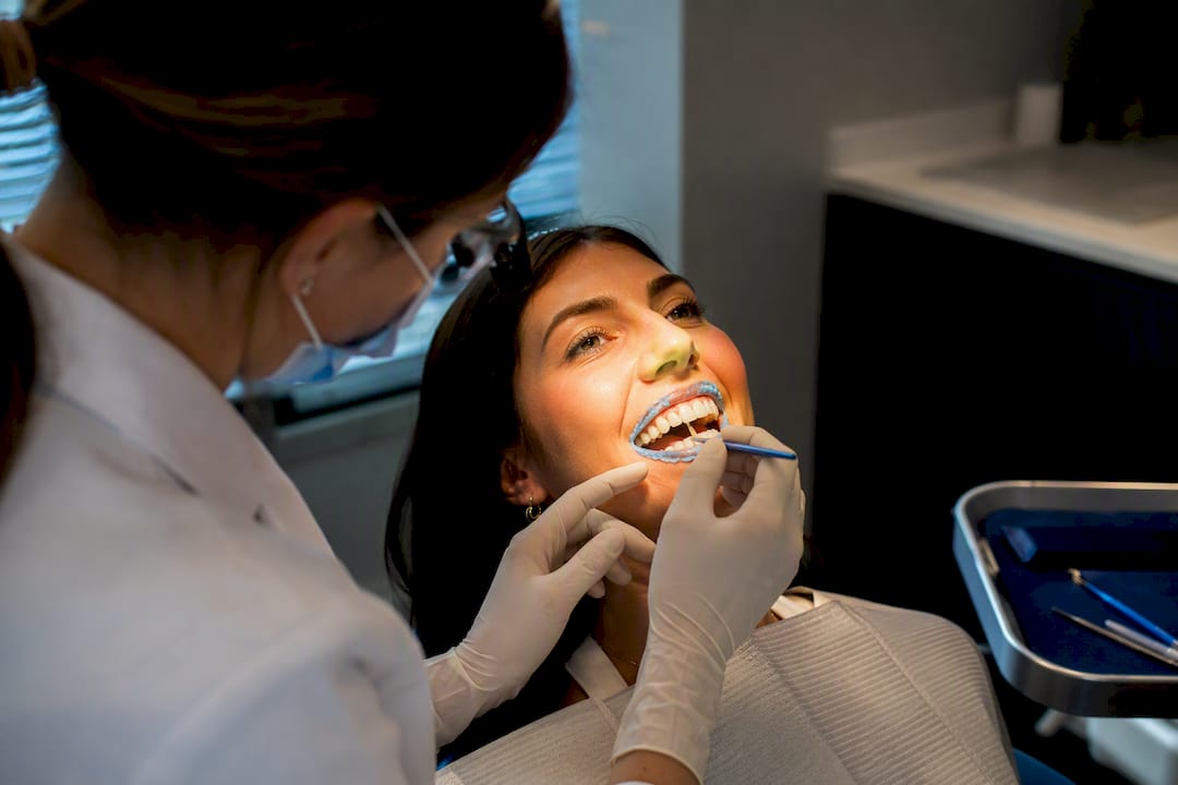 Dentist applying professional whitening gel