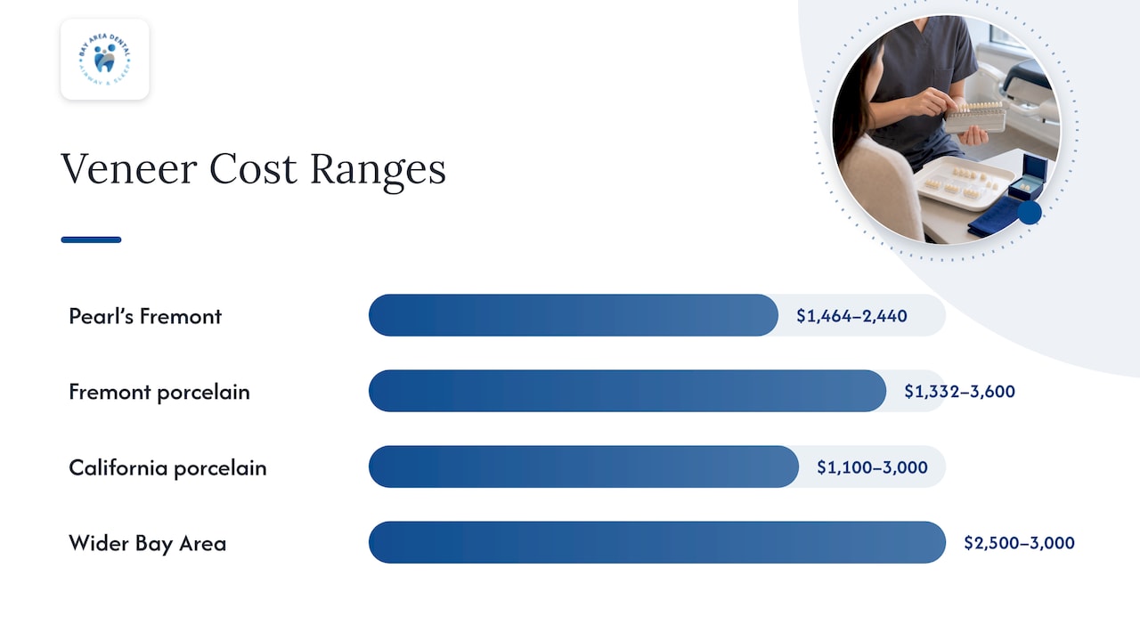 Reported veneer price ranges by location
